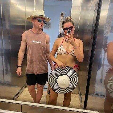 We were very sunburned