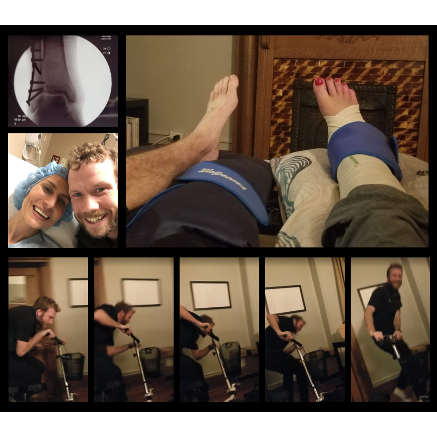 Maybe it's a high ankle sprain he said. Then he brought her ice packs for weeks and made her laugh by racing around on and occasionally falling off her knee scooter.