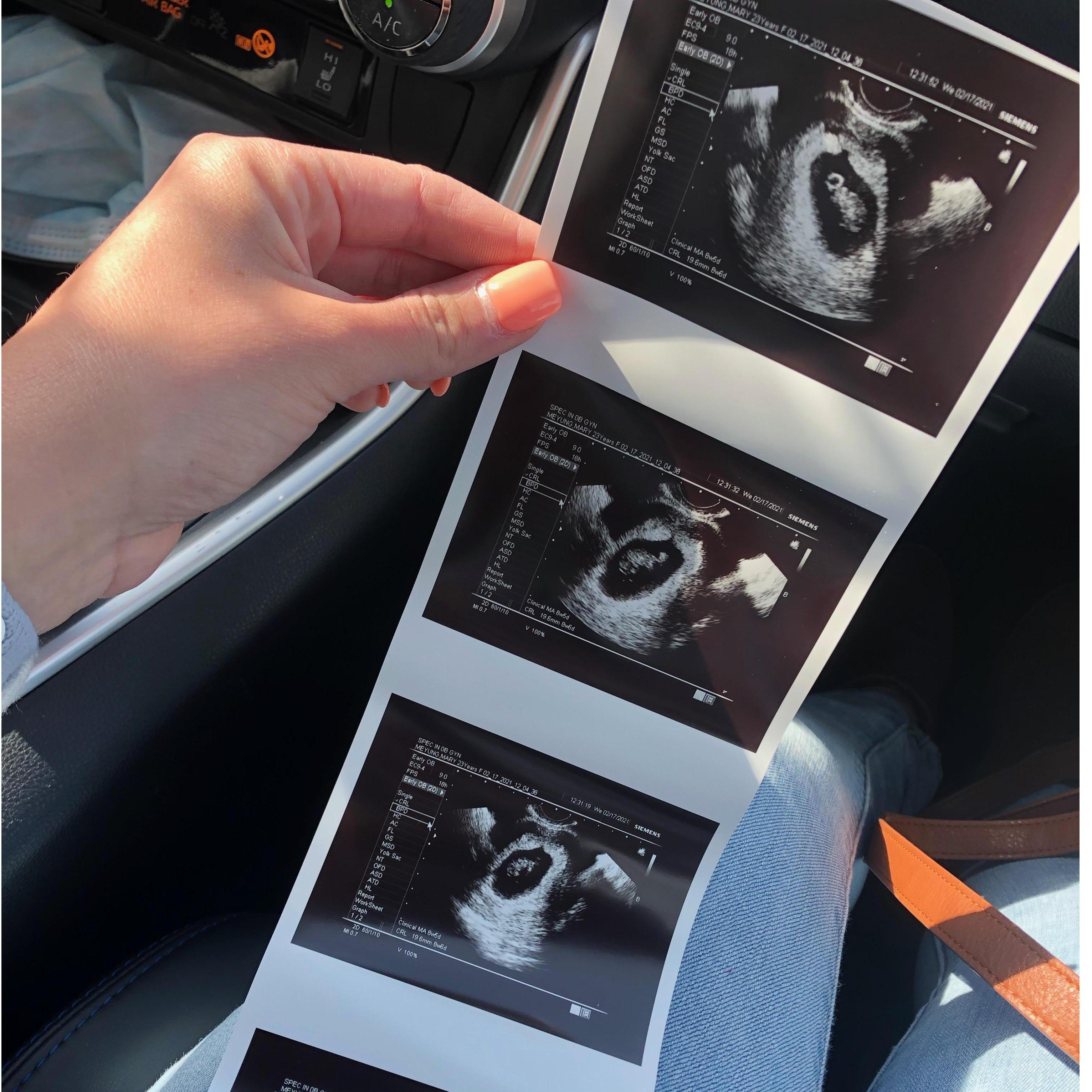 Baby Spanos' first photo