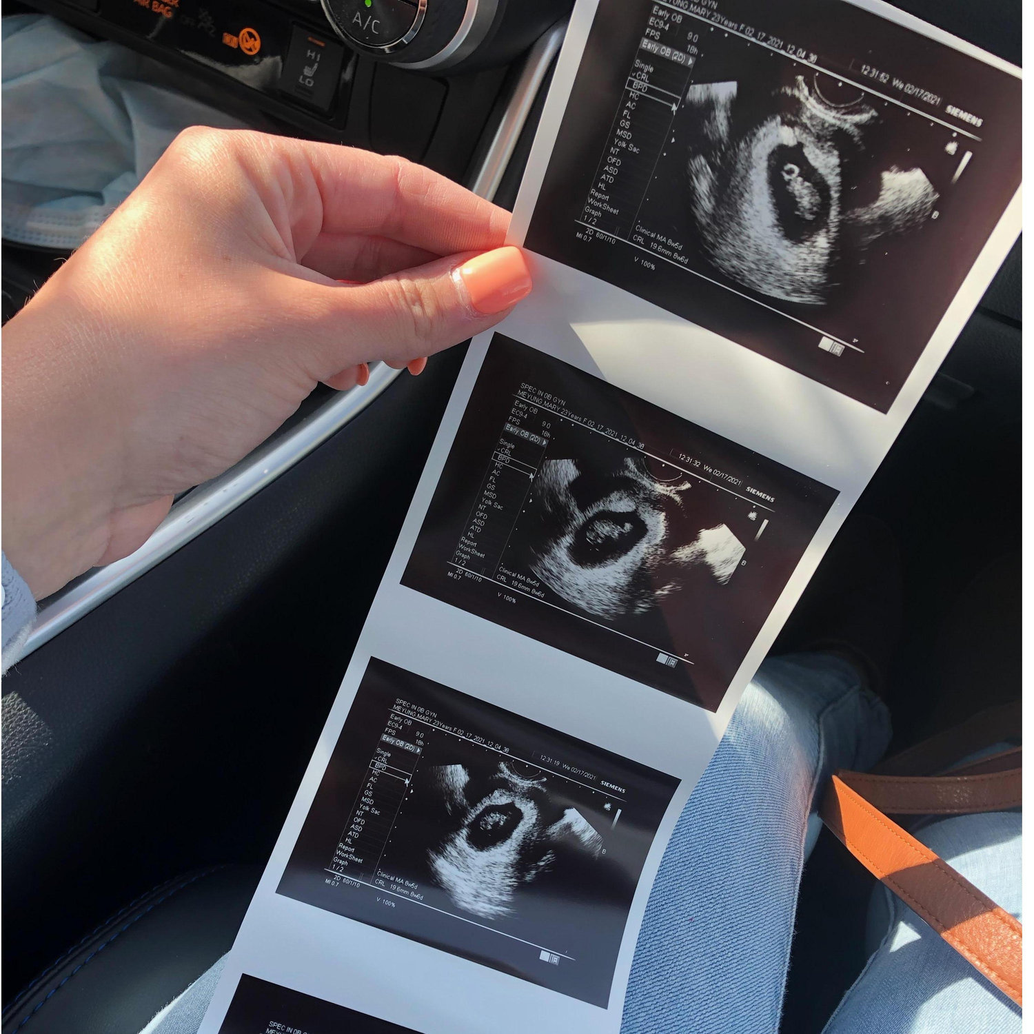 Baby Spanos' first photo