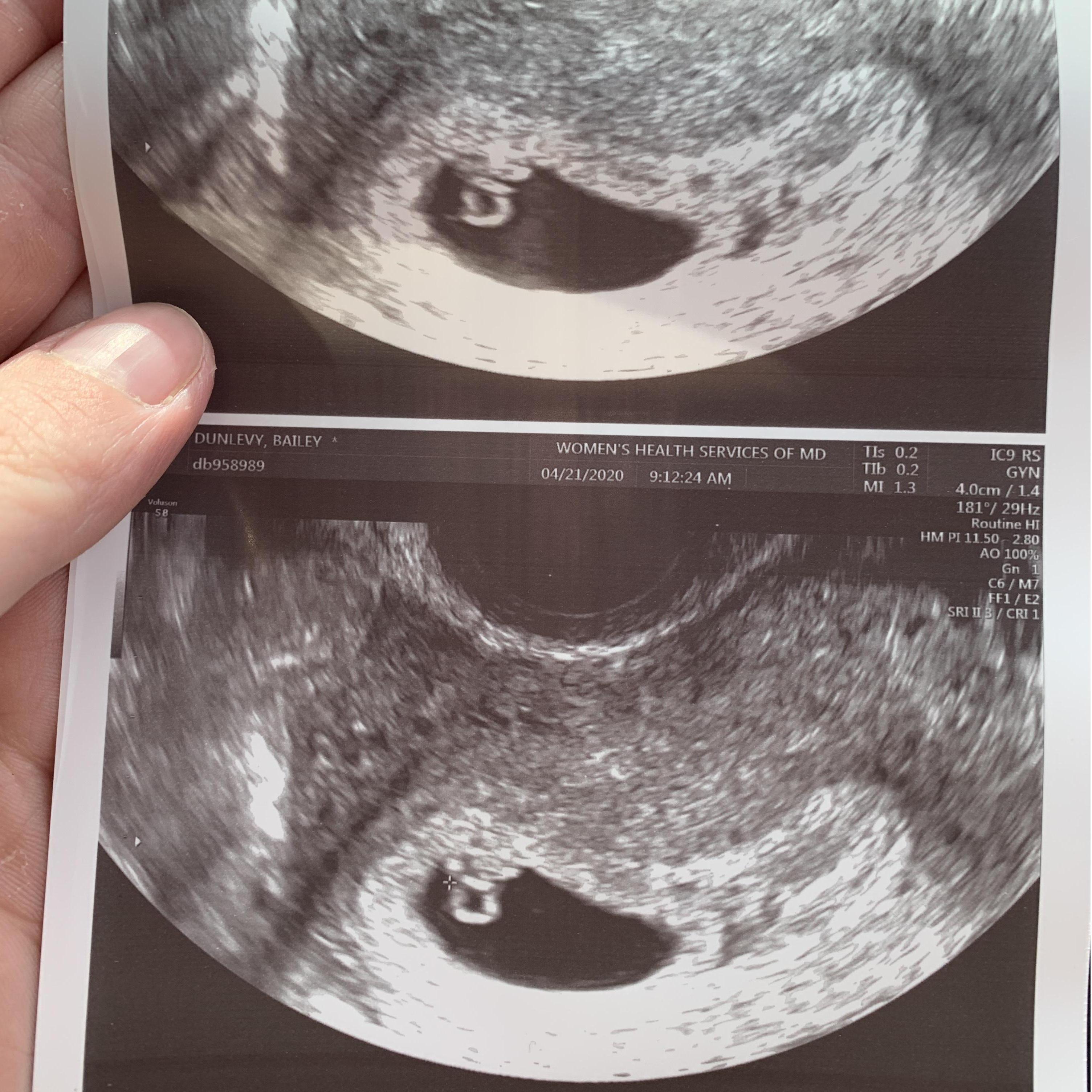 Little miss Estelles first photoshoot!