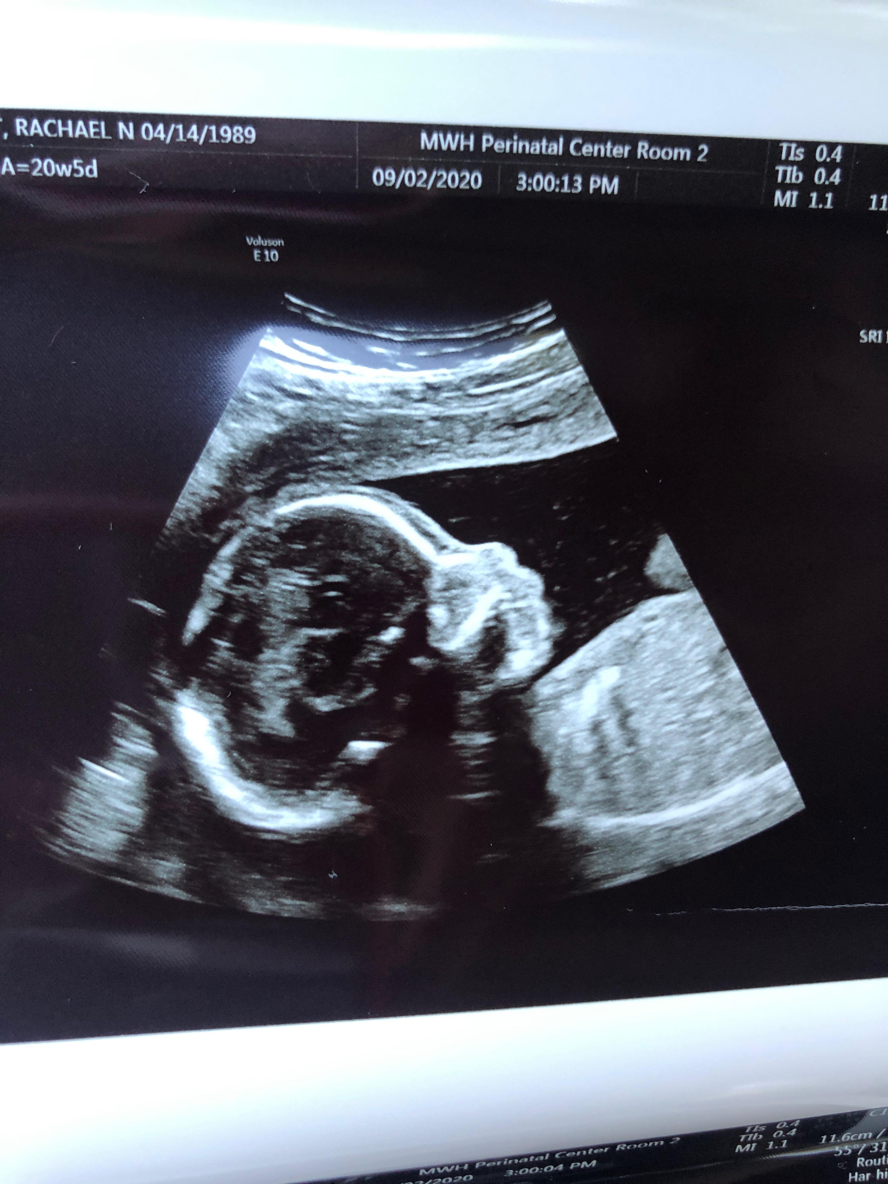 The Wedding Website of Rachael Bruechert and Cody Bruechert