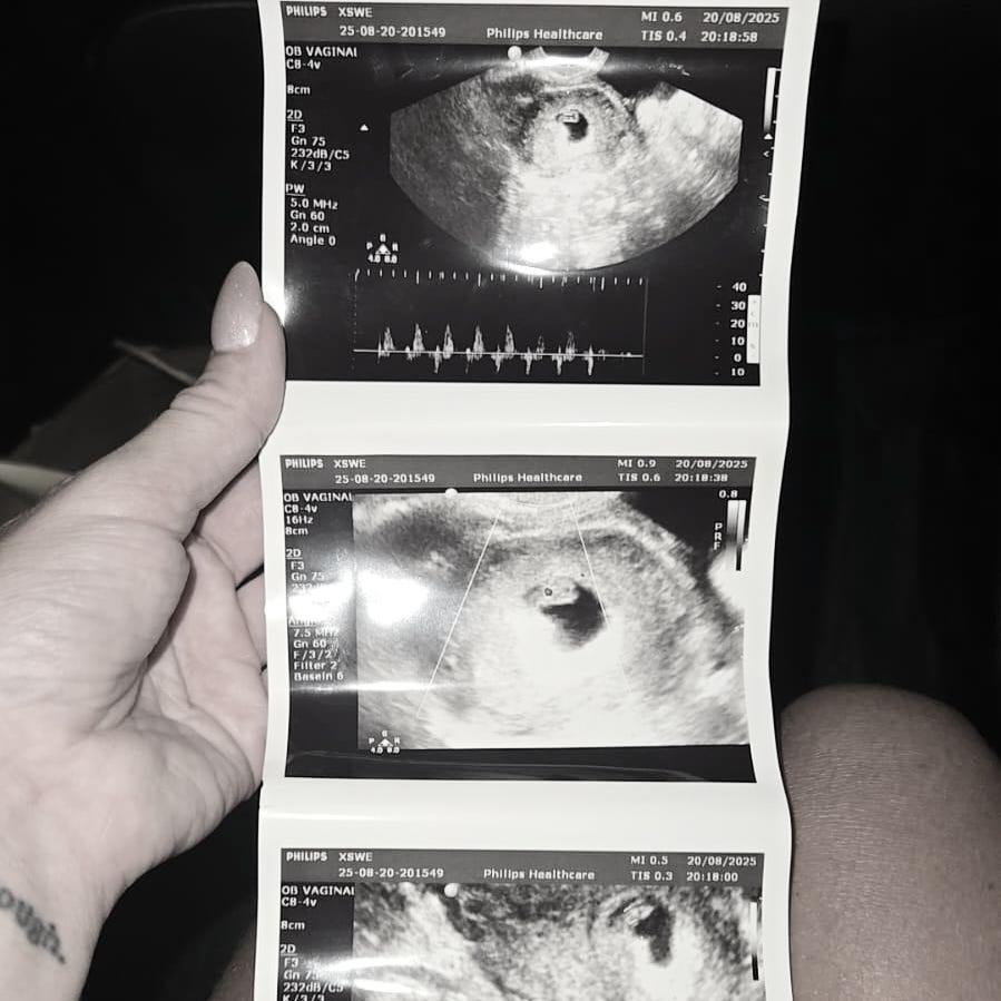 Our little miracle