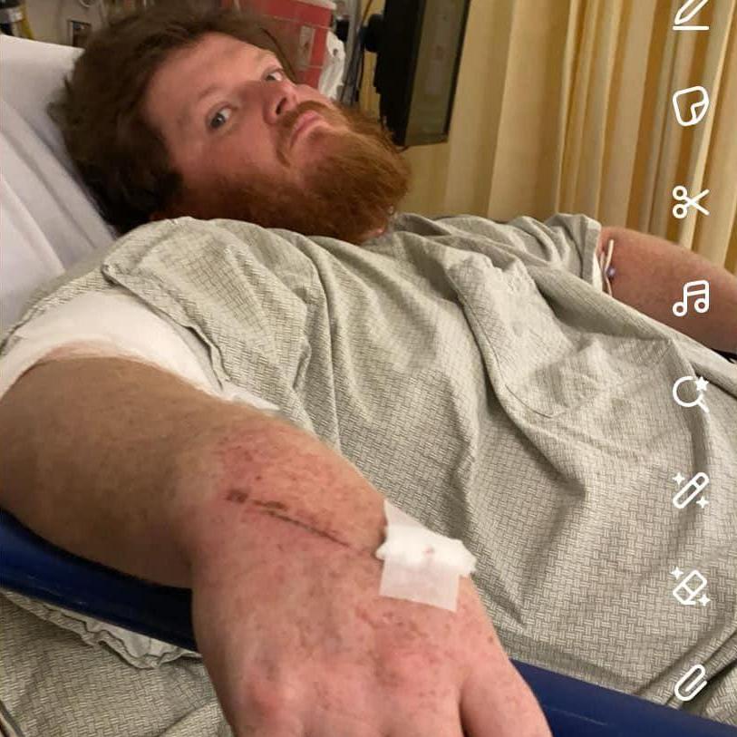 Post surgery on superbowl sunday!