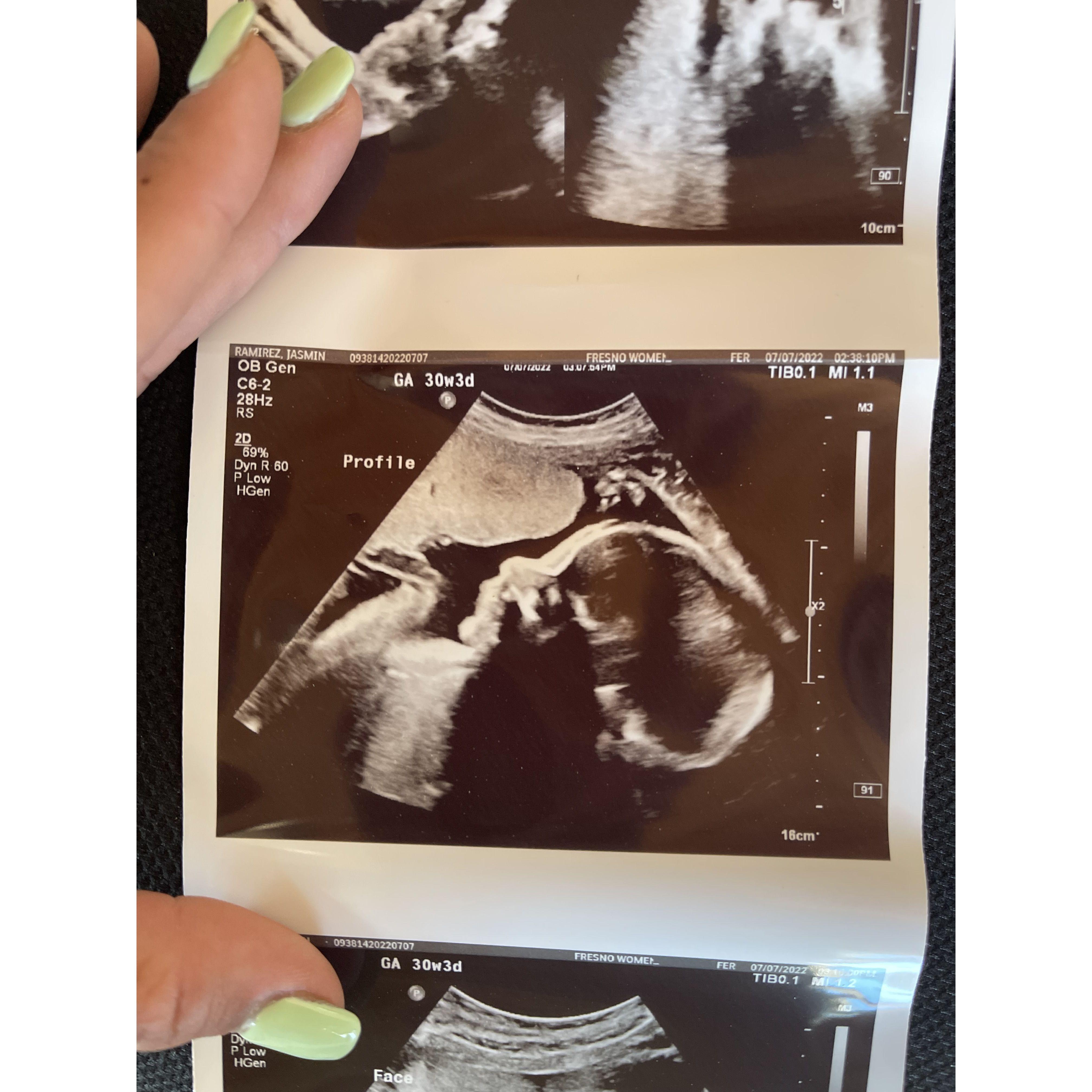 Sal and Jasmin expecting Baby Boy # 2