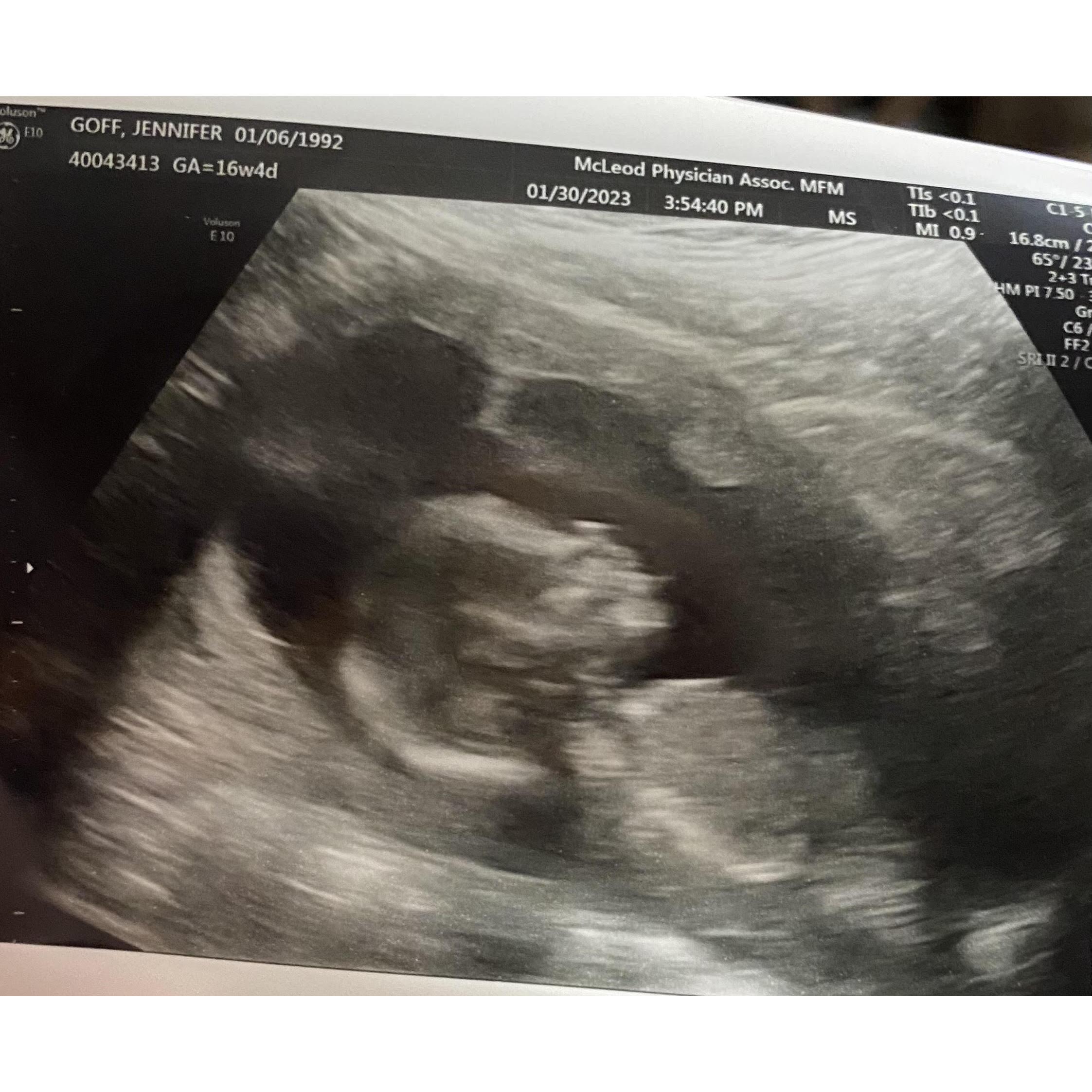 16 Week Ultrasound