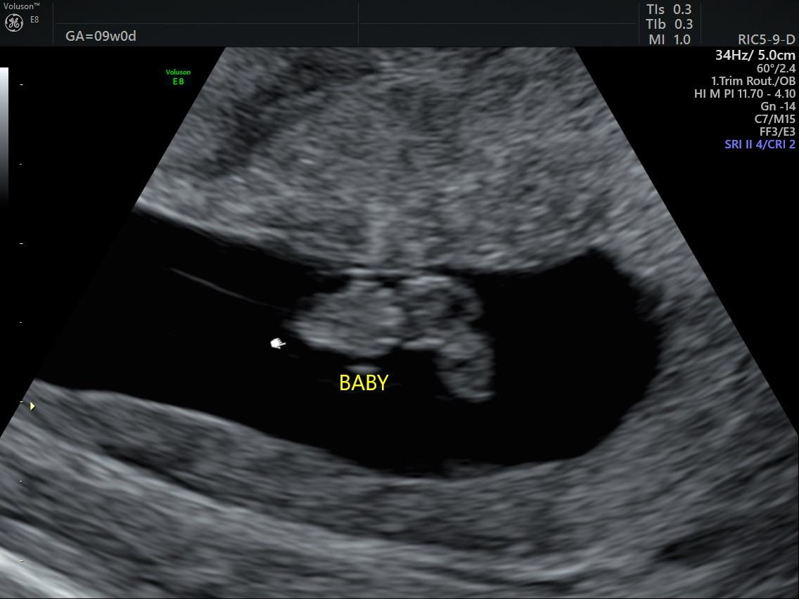 Baby’s first picture!
