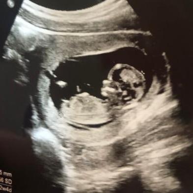 Our baby boy at 12 weeks!