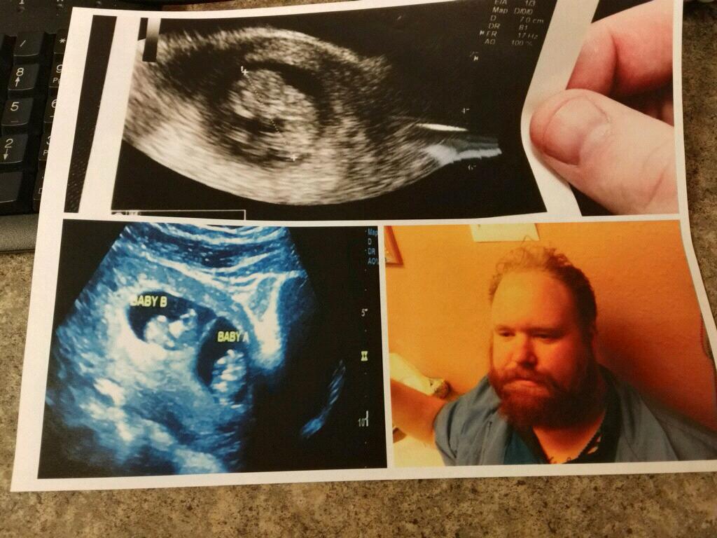 We thought we were only going to have one baby. The next week- we found out we were having two. That is Andy's photo post finding out about twins.
