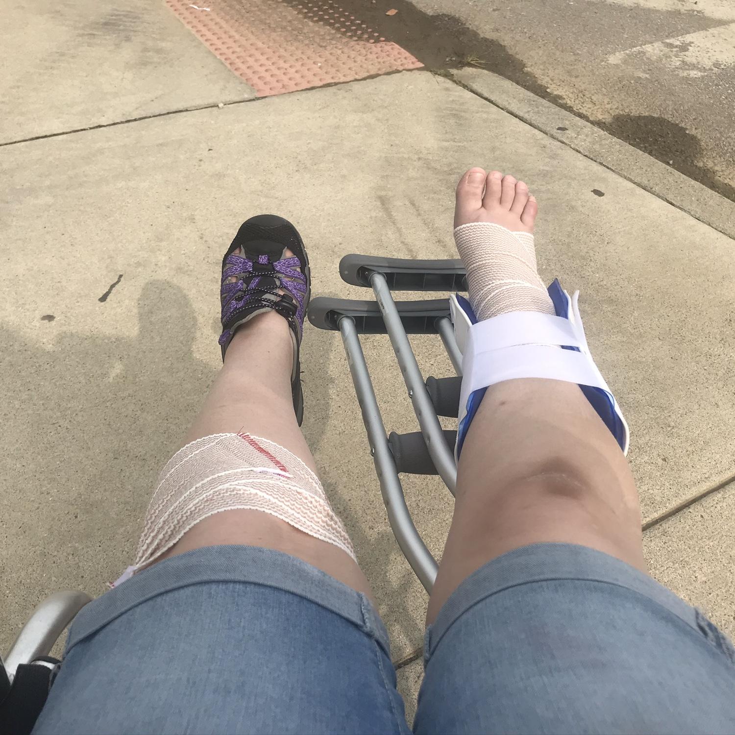 ❗️September 14, 2020~ First Incident Together. While on a date at the zoo, I fell and badly sprained my right ankle and cut my right knee on rocks. Adam displayed his caring abilities at a new level.
