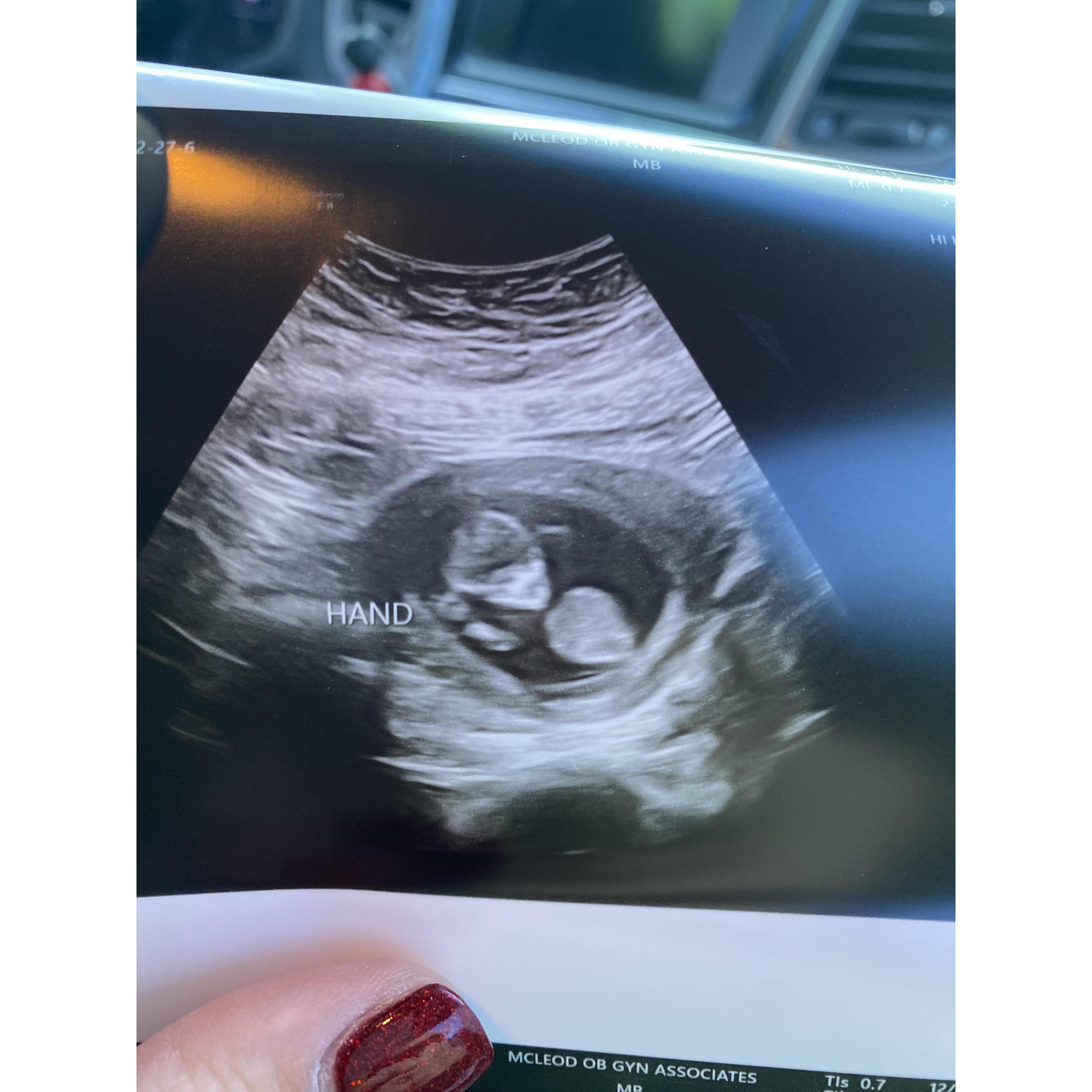12 Week Ultrasound