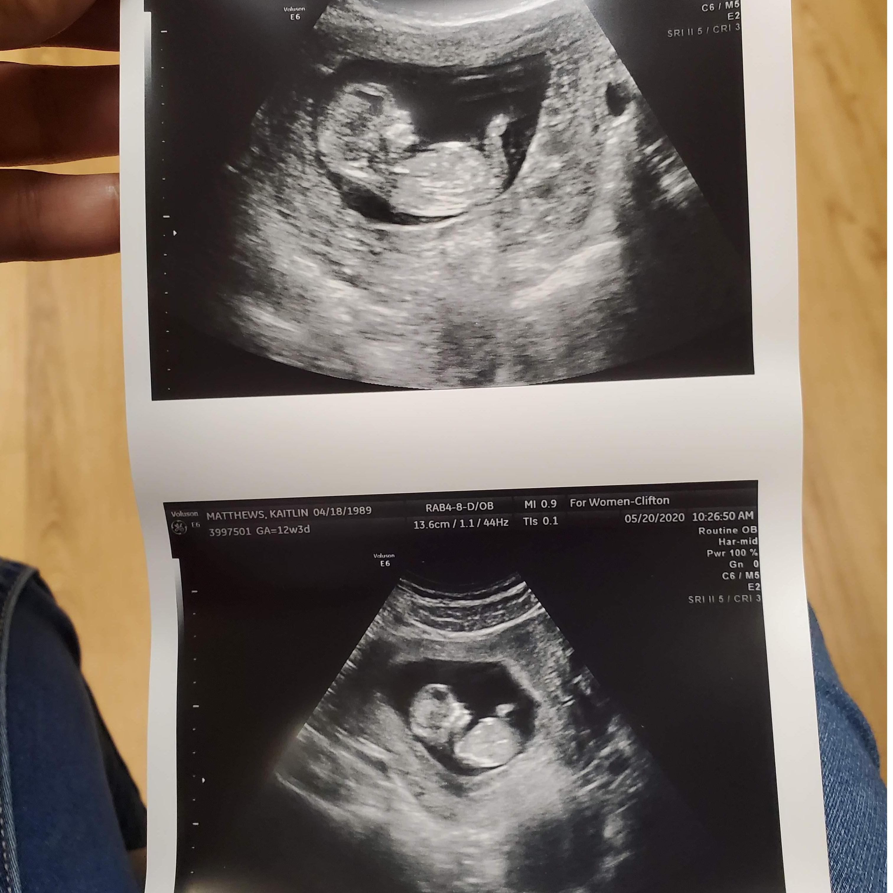 Family Beginning