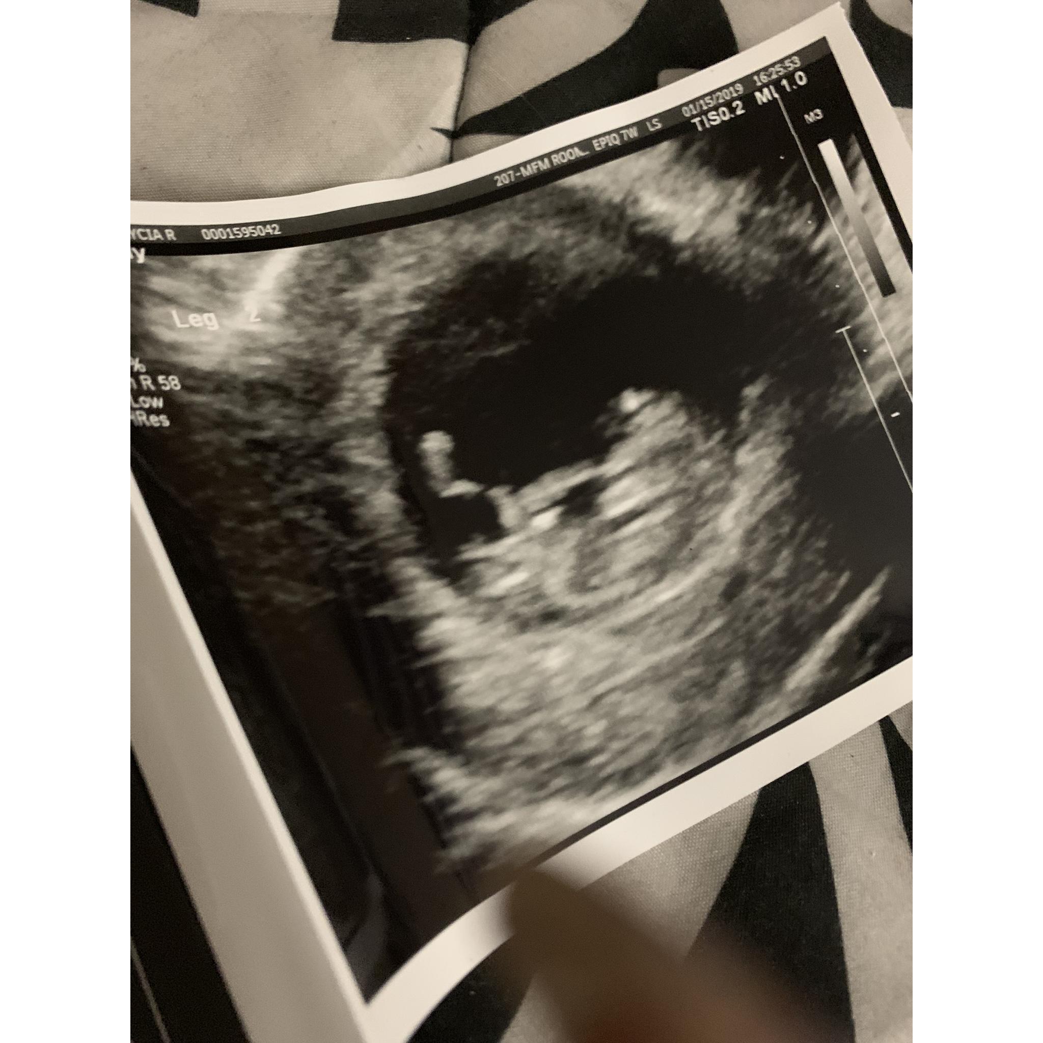 “Long legs better to kick mommy with...only while I’m in here”