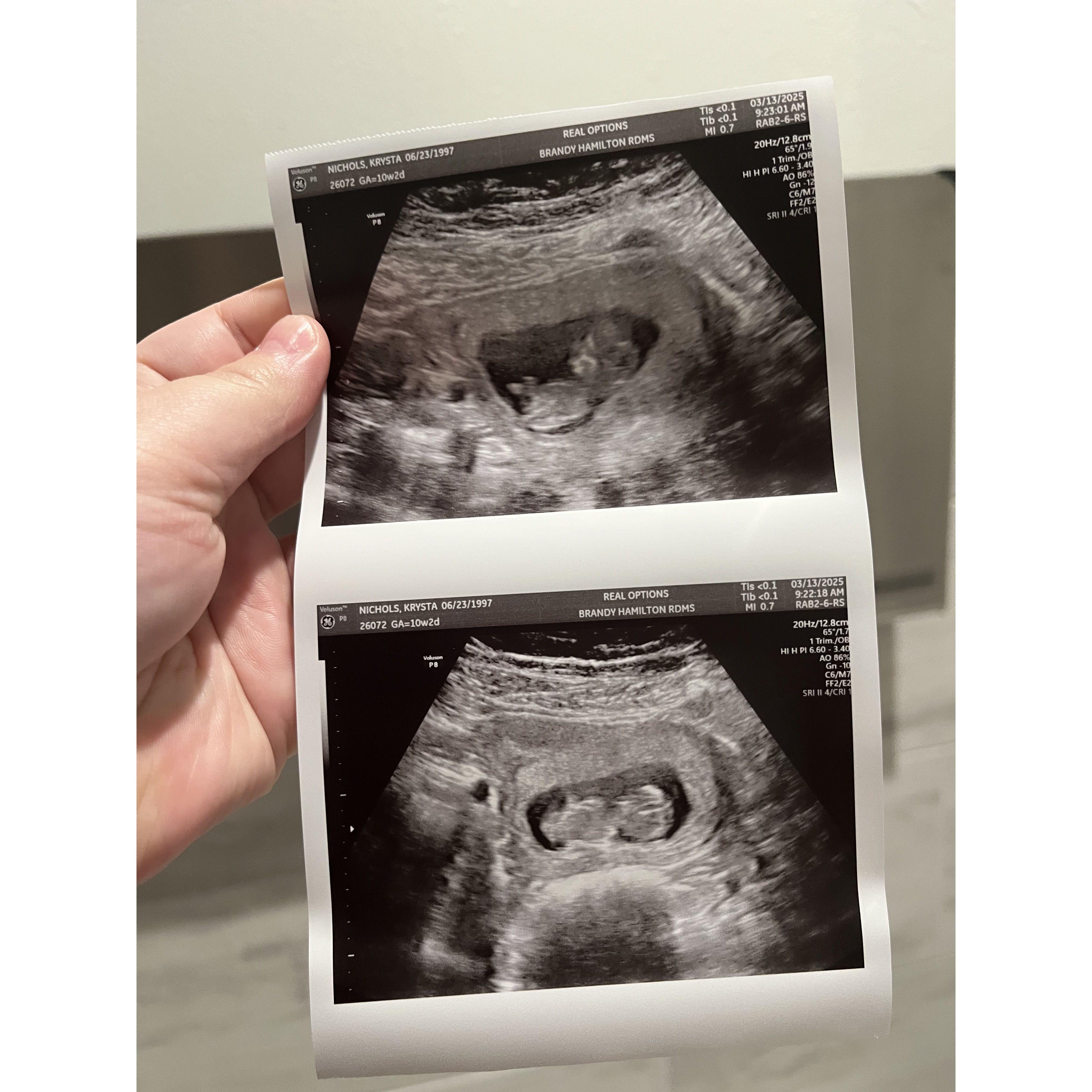 Our little Bundle of Joy Greyson Ace Romero