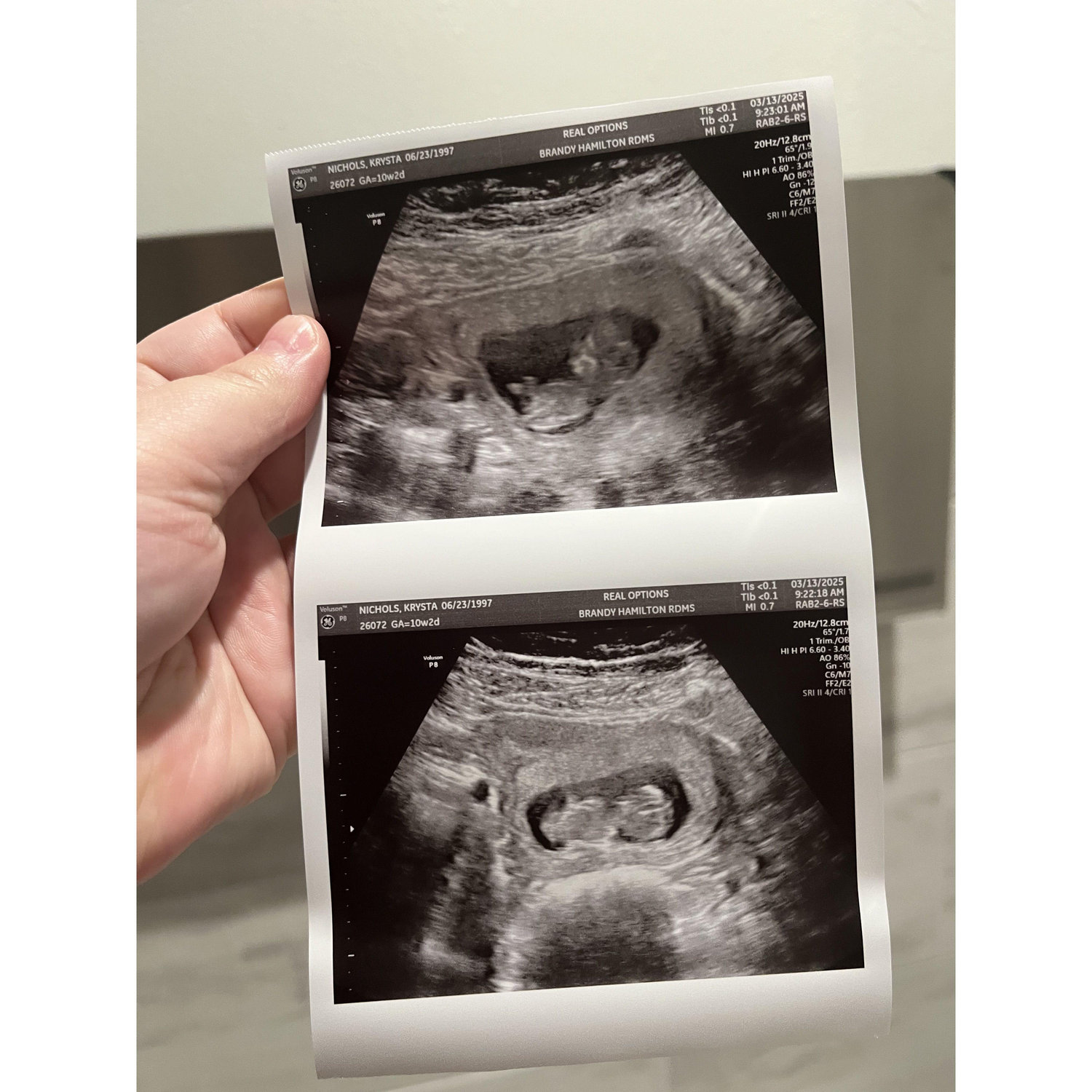 Our little Bundle of Joy Greyson Ace Romero