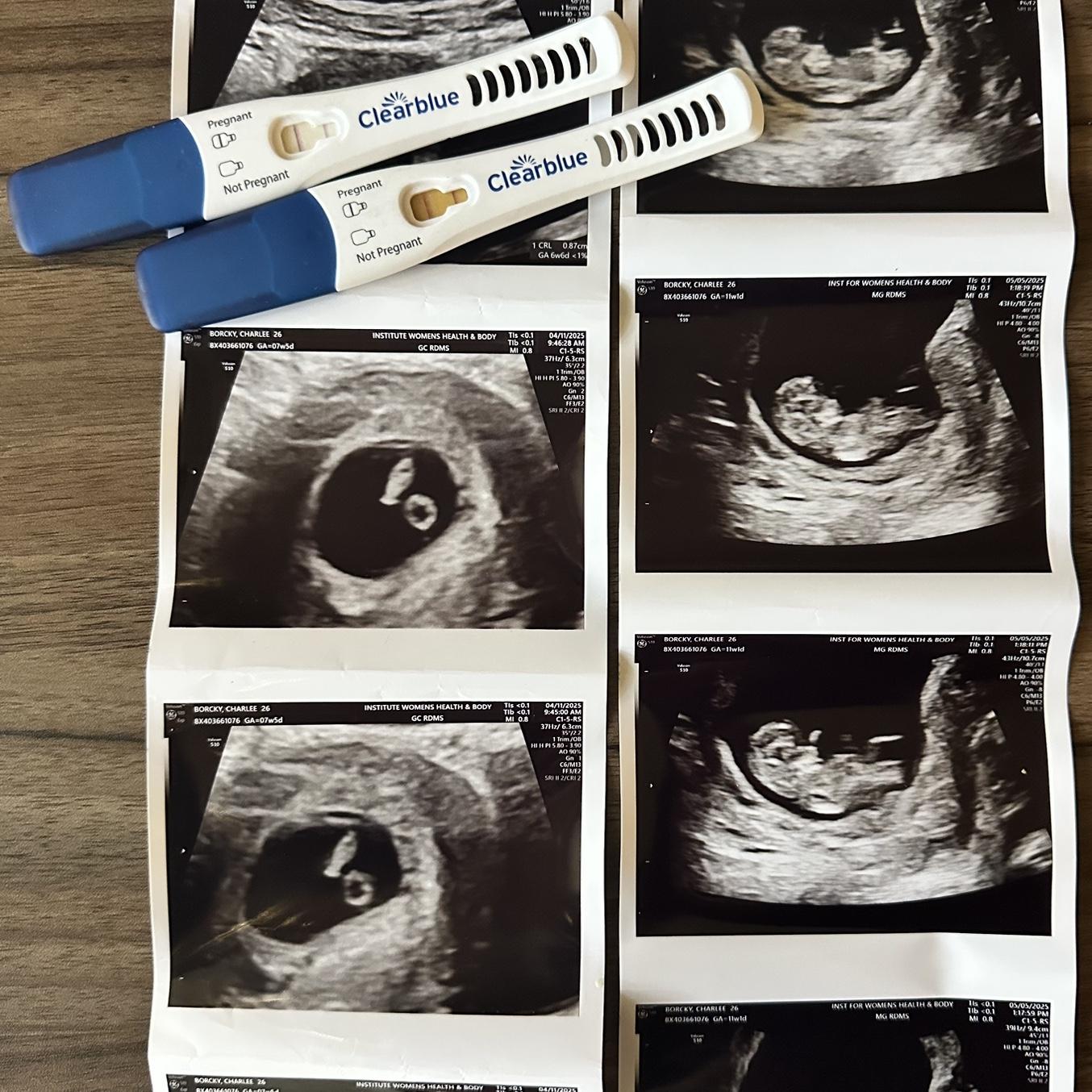 Baby Girl will be joining us! 🩷