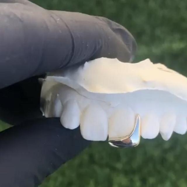 Gold Teeth