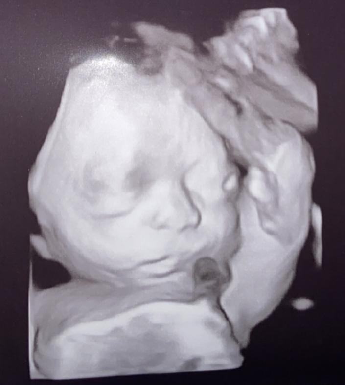 The Wedding Website of Arielle Anthony and August TheATeam!