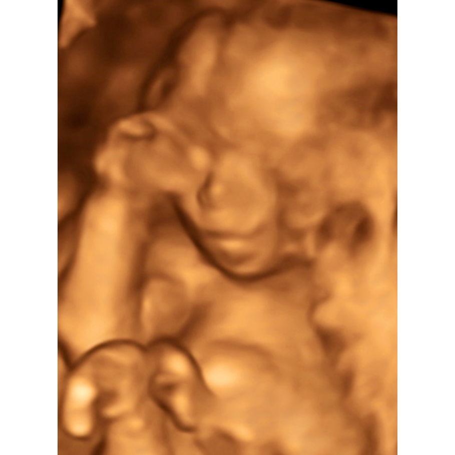 Baby Girl Graves due August 2025!