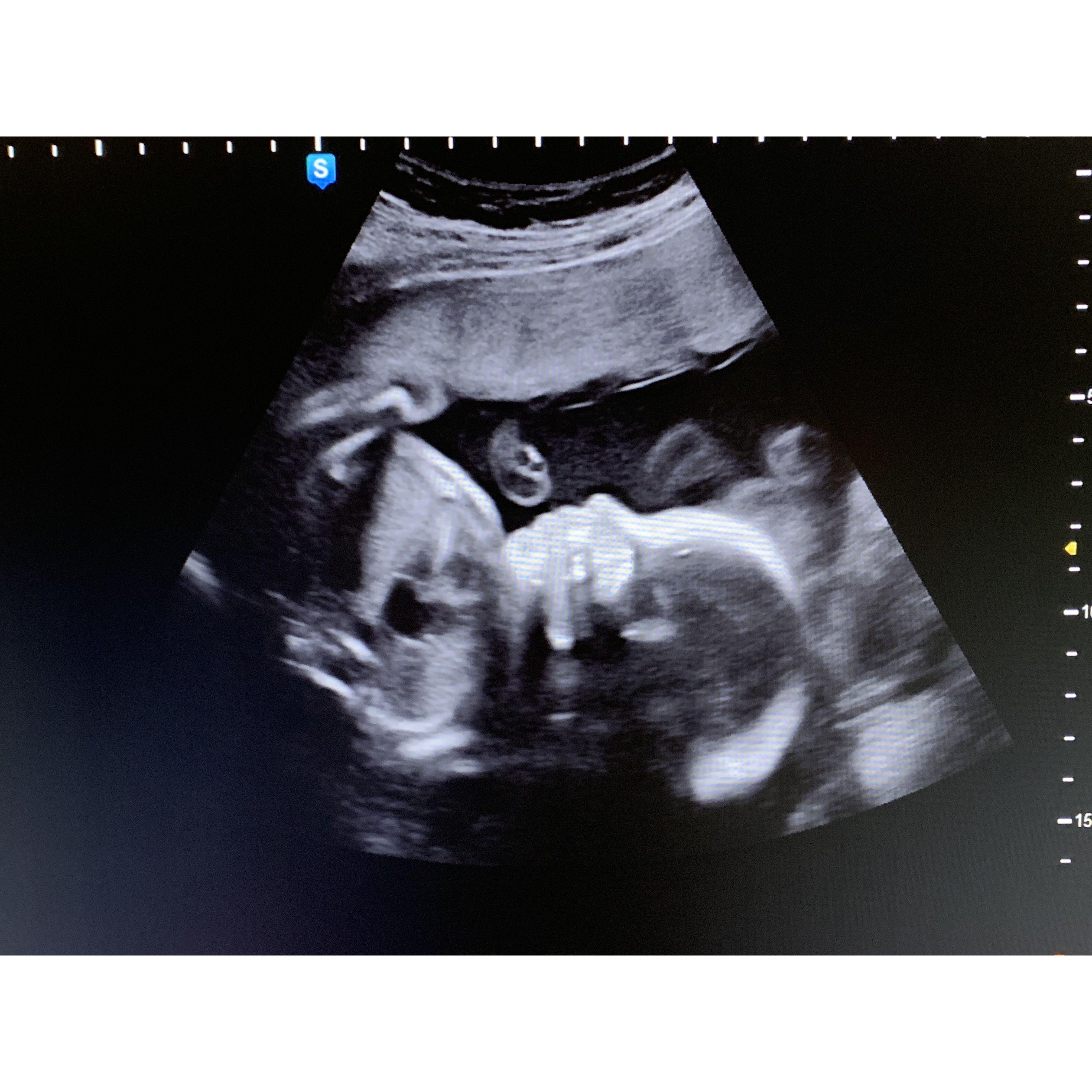 Baby Knapp! Coming April 2023