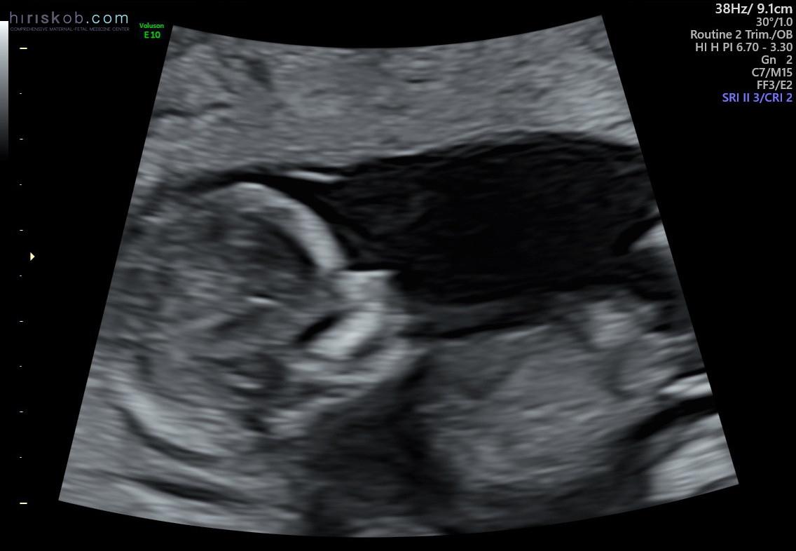 Our baby girl!