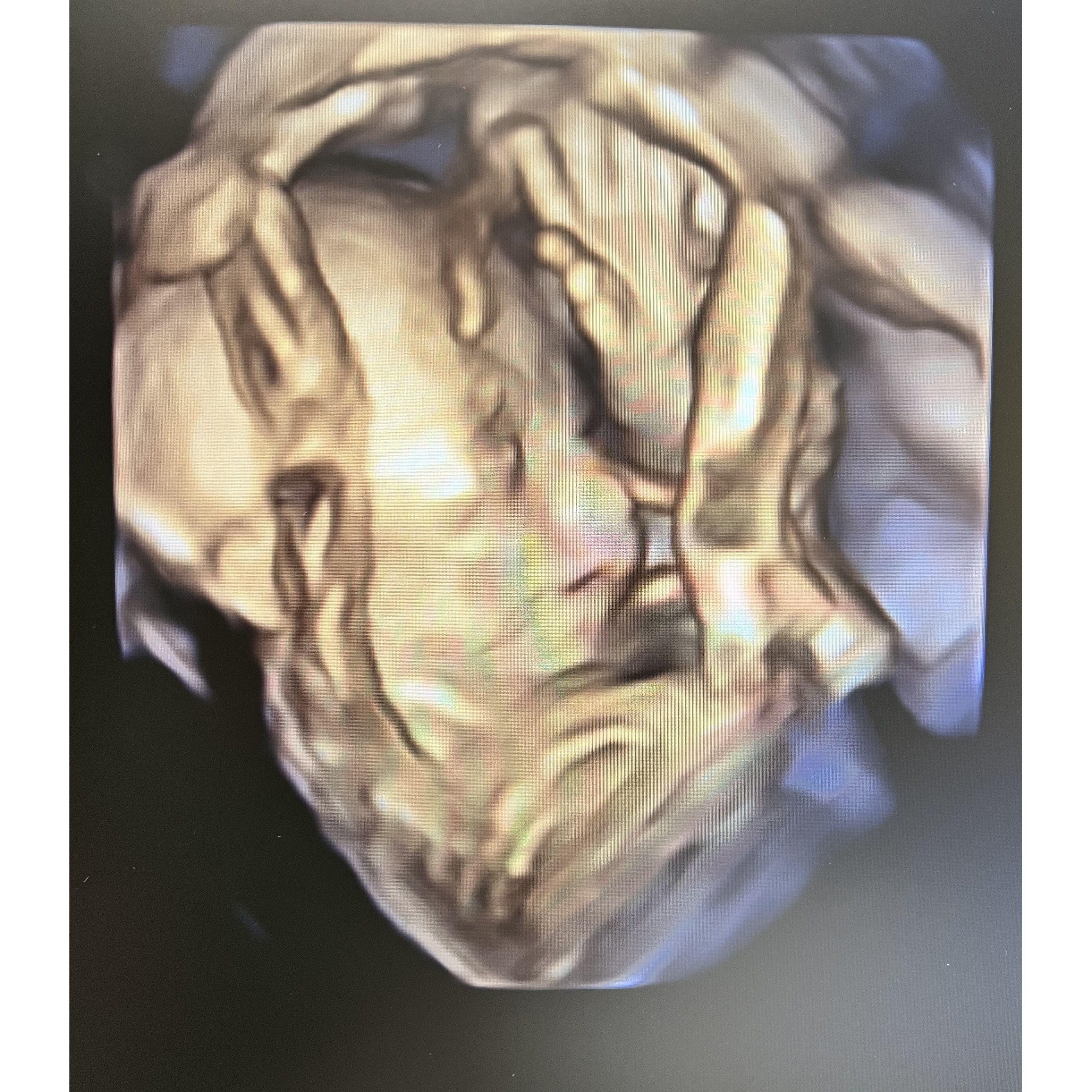 3D Sonogram