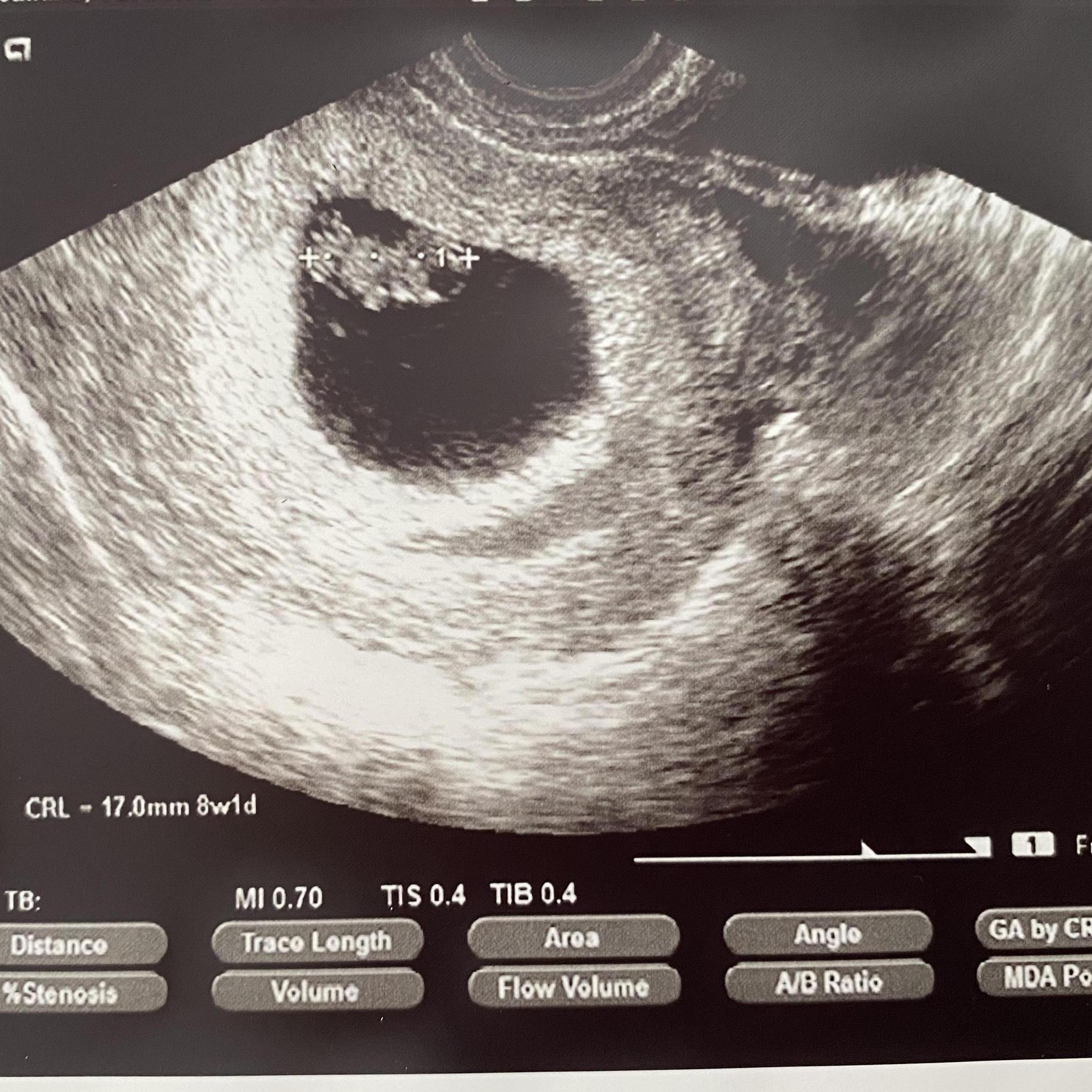 6/3/21 - One of Baby Flatow's first pictures!