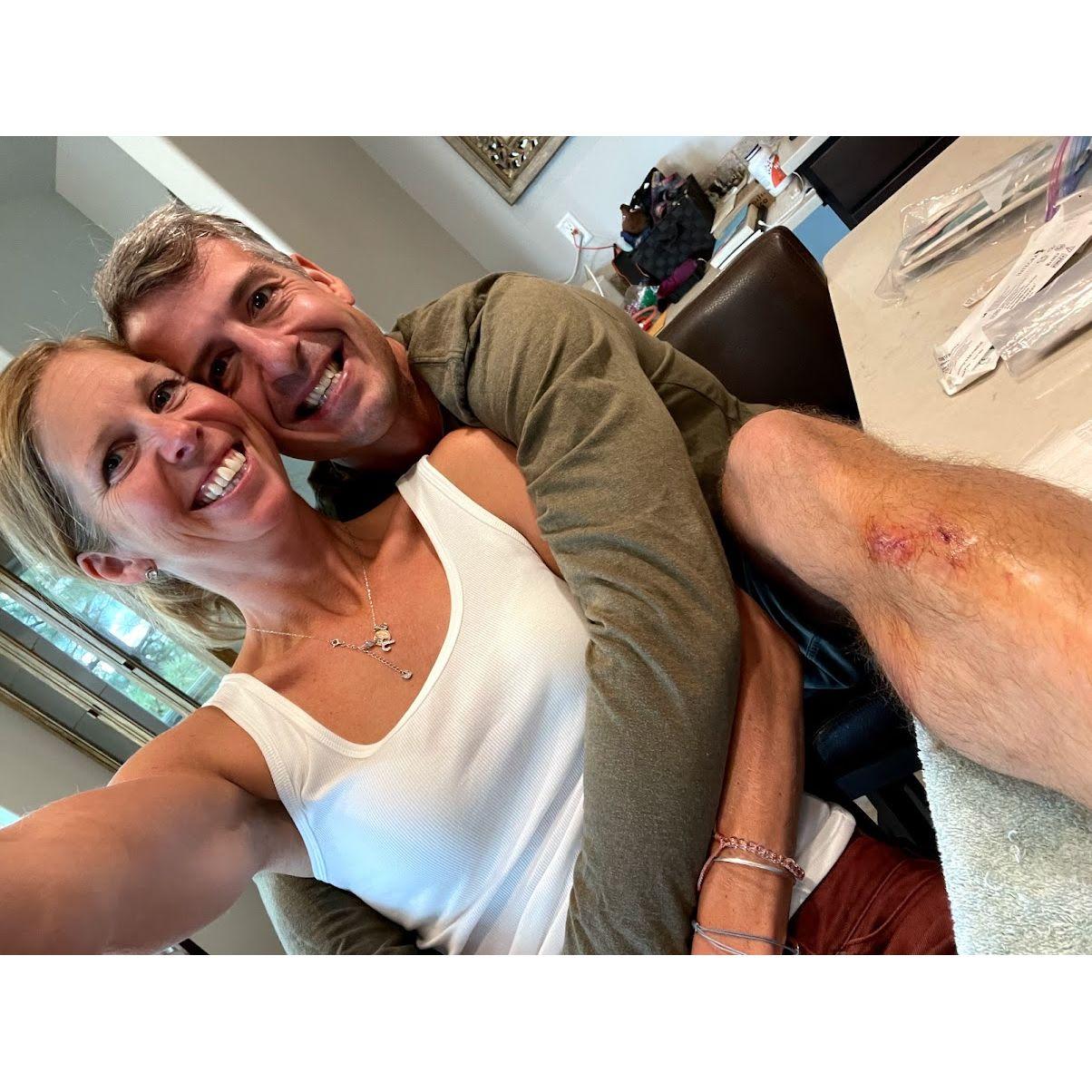 Our first photo together, right after Gen gave Kyle stitches on his kitchen counter