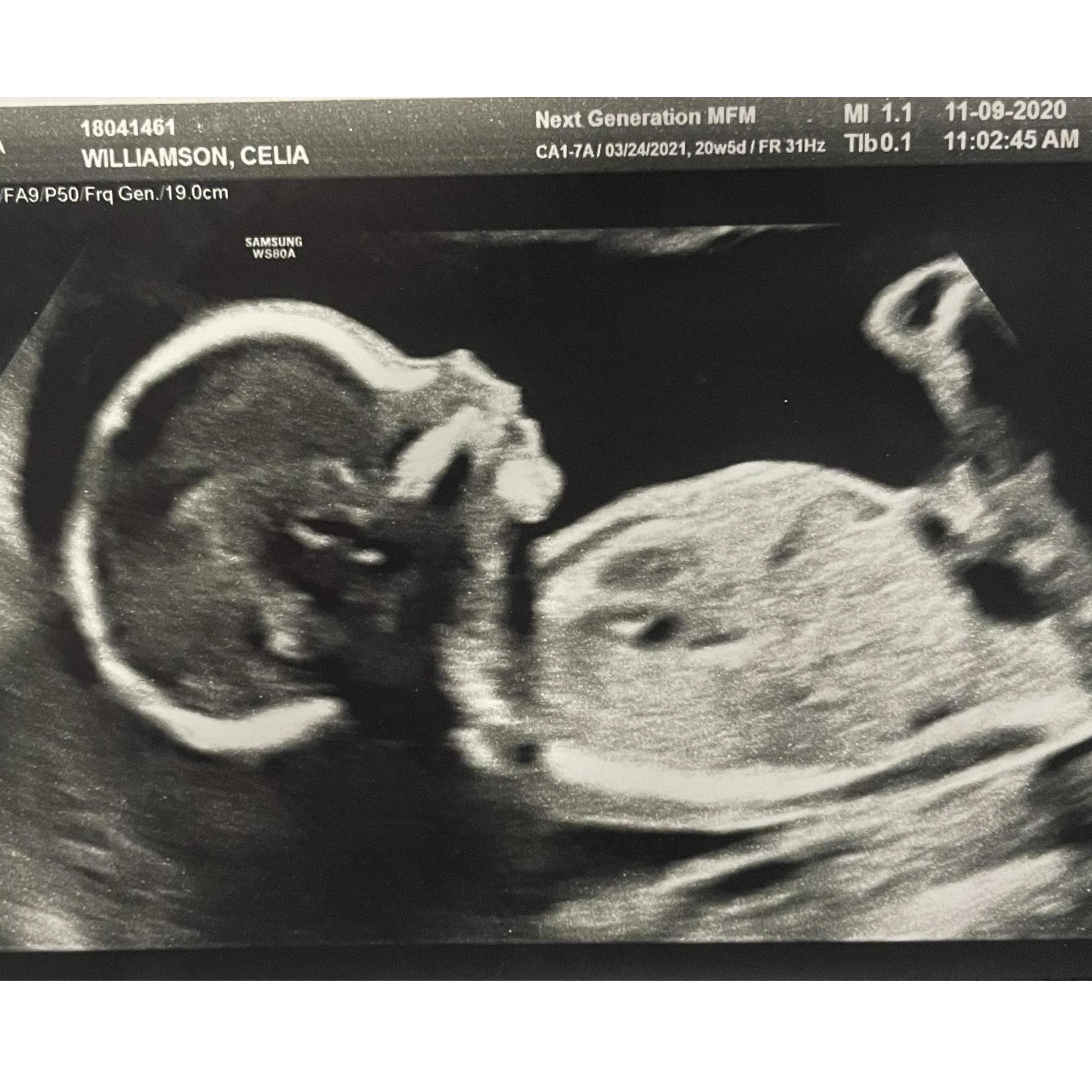 22 Weeks