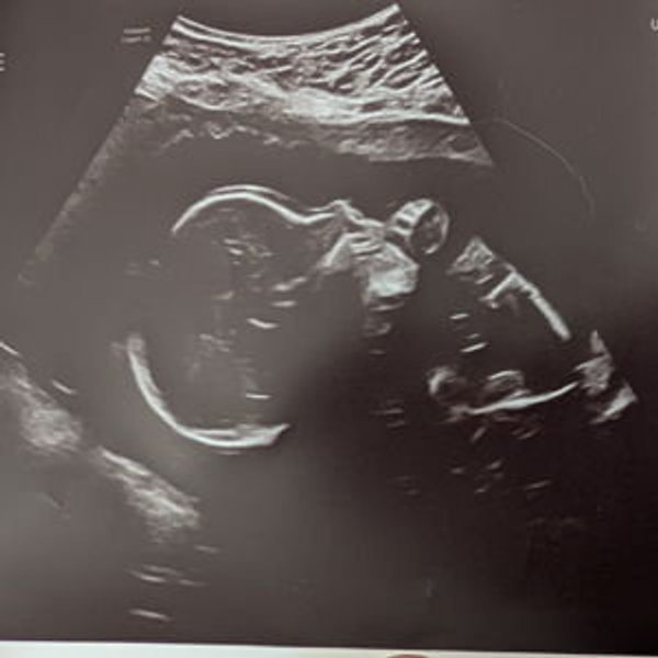Baby Cash Fund