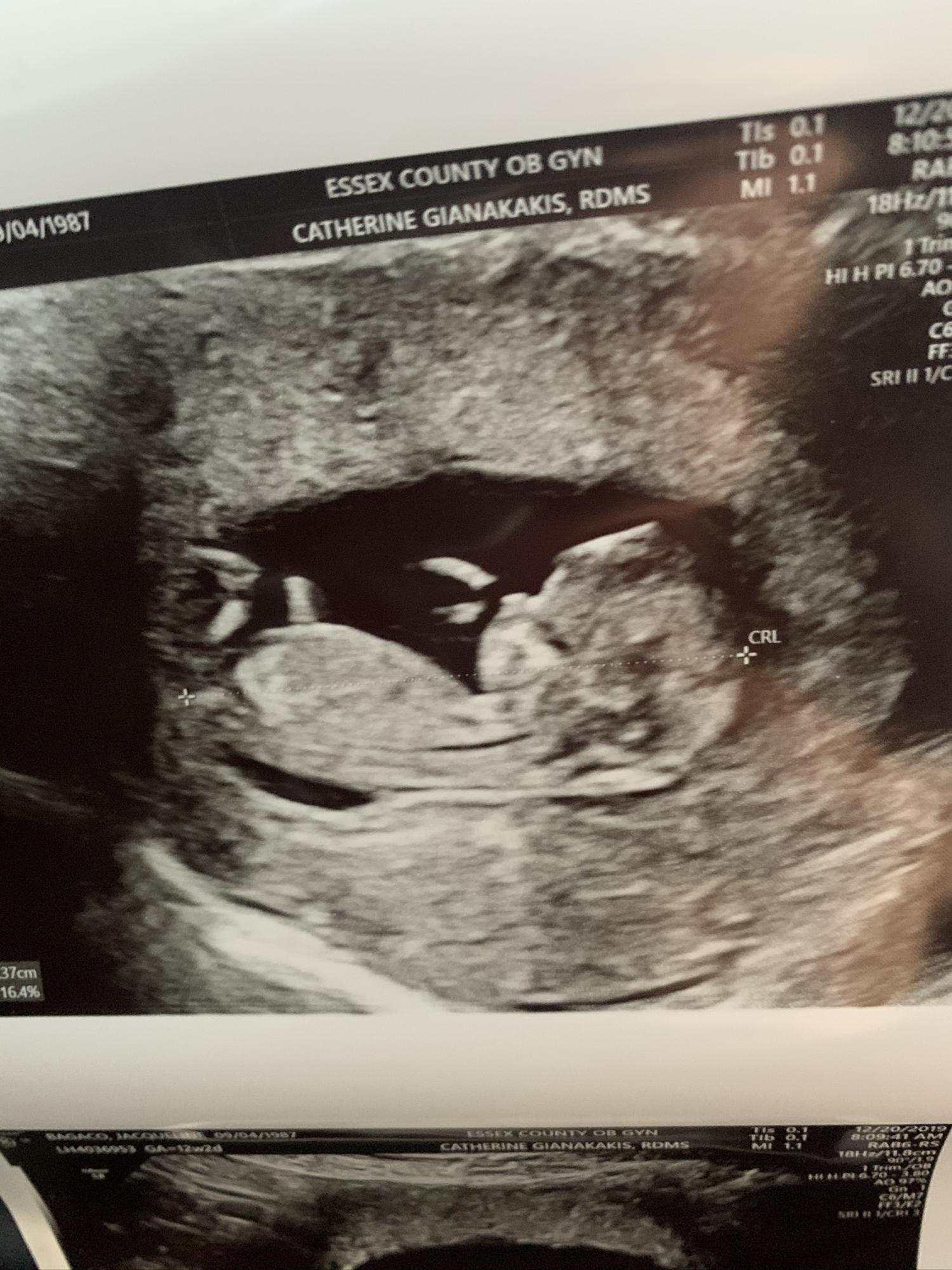Our love manifested!